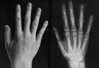 © Evgenij Yulkin/Stocksy - Teen girl's hand next to x-ray