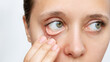 Cropped shot of a young caucasian woman showing off her pale conjunctiva isolated on a white background. Iron deficiency anemia. Reduced hemoglobin