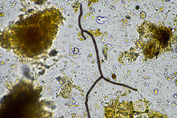 Sticker - soil microbes organisms in a soil and compost sample, fungus and fungi and under the microscope in regenerative agriculture. in australia.
