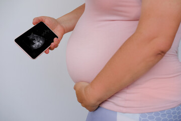 Poster - pregnant woman holds mobile phone with ultrasound screen examination, small child rolls over in mother's belly, concept pregnancy reproduction, healthcare pregnancy, happy motherhood, selective focus