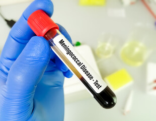 Poster - Blood sample for Meningococcal disease test, this disease caused by bacteria called Neisseria meningitidis. STDs