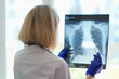 Doctor pulmonologist examining x-ray photograph of lungs