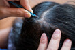 Woman hands plucking gray hair with tweezers from head.