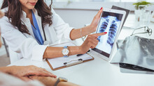 Lung Cancer Concept. Doctor Explaining Results Of Lung Check Up From X-ray Scan Chest On Digital Tablet Screen To Patient. The Doctor Is Analyzing And Clarifying Images Of The Patient's Lung X-rays.