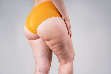 overweight thigh, woman with fat hips and buttocks, obesity female body with cellulite on gray backg