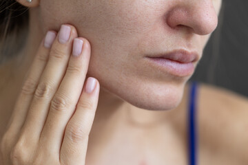 Young woman with a problem dry skin and with big pores.