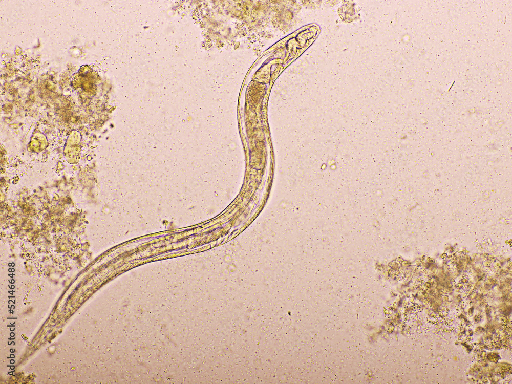 Foto Strongyloides stercoralis or threadworm in human stool, analyze by ...