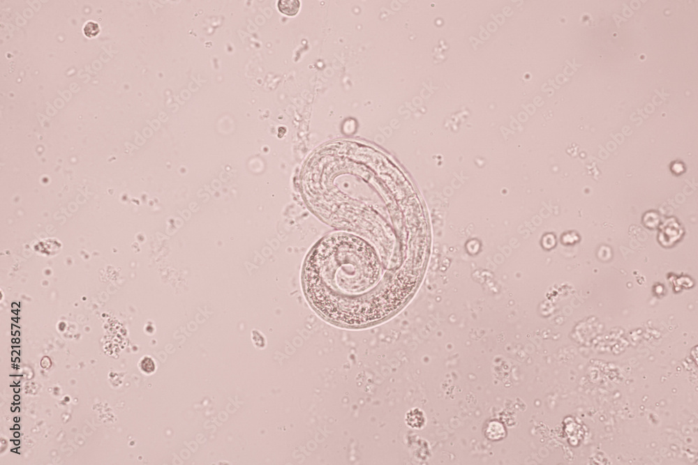 Foto de Stock View in microscopic Strongyloides stercoralis or ...