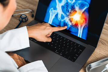 Wall Mural - Close up of doctor showing a x-ray of pain in the hips on a laptop. 