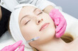 © Ксенич Шитовкина - Injection in the face at the spa salon. The doctor's hands. Biorevitalization. Facial care with hyaluronic acid.