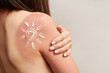 Sunburn on female shoulder, skin care and protection concept