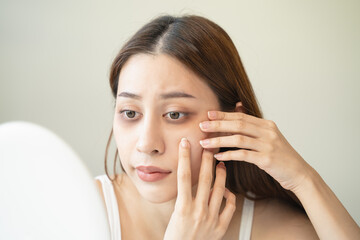 lack of sleep problem,  Worried Asian young woman pointing finger at dark circles under her eyes