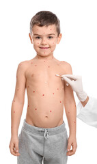 Sticker - Doctor applying cream onto skin of little boy with chickenpox on white background. Varicella zoster virus