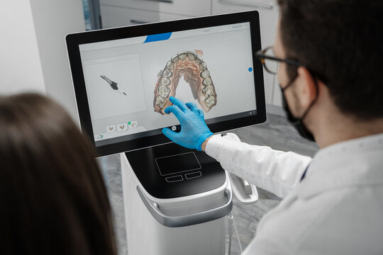 Male doctor show results of digital intraoral scan of patient teeth in 3D on display.