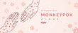 Monkeypox virus banner for awareness and alert against disease spread, Hand rash with monkeypox. Monkey Pox virus outbreak pandemic, pidemic from animals to humans. Monkeypox virus background