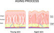 Aging process. comparison of Young and aged skin. Collagen, Elastin and fibroblasts