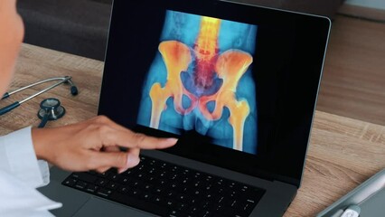 Wall Mural - Woman Doctor showing x-ray with pain in the hips and spine on a laptop. Left to right shot