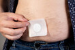 A modern medical patch for prostatitis and urinary tract infections. A man glues a urological patch on his stomach, close-up
