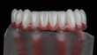 excellent dental prosthesis of the lower jaw made of polymer on a model on a black background