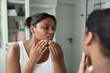 © gpointstudio - Young African-American woman in the bathroom having acne problems with face.