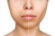 Cropped shot of young woman's face before and after plastic surgery buccal fat pad removal on a white background. A lower part of face with clear highlighted cheekbones. Result of surgery, comparison