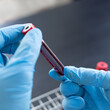 © Puwasit Inyavileart - Scientists or doctors collect blood samples from new strains of virus patients for analysis and vaccination in the research laboratory, Vaccine research to eliminate viruses concept.