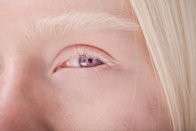 Close-up Of Young Face Of Albino Girl With Blue Eyes And White Eyelashes