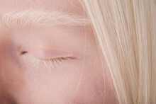 Close-up Of Albino Girl Having Natural Beauty With White Eyebrows And Eyelashes