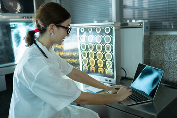 Woman radiology doctor working with laptop computer and checking x-ray film of patient in health care medical laboratory at hospital