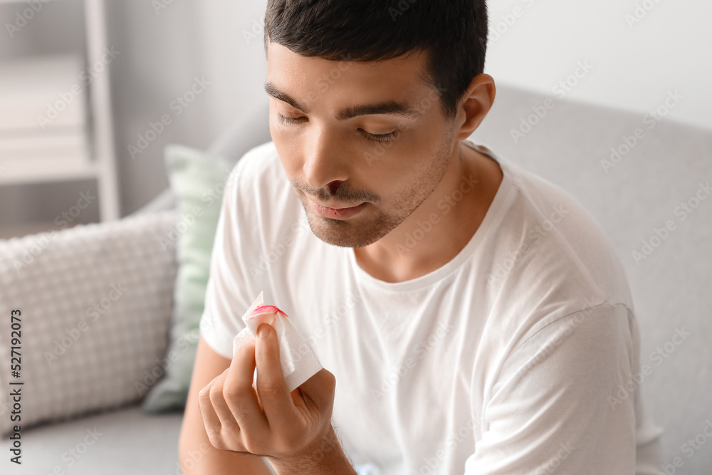 Young man holding tissue with nasal blood at home, closeup