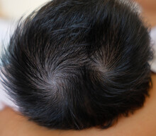 Asian Child's Head Top View Seeing Black Or Dark Brown Hair With Double Spiral Pattern.