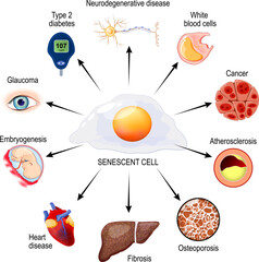 Wall Mural - Cellular Senescence and health risks. roles that senescent cells play in the human body.