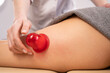 © Михаил Решетников - Woman on a session of anti-cellulite massage with a vacuum jar.