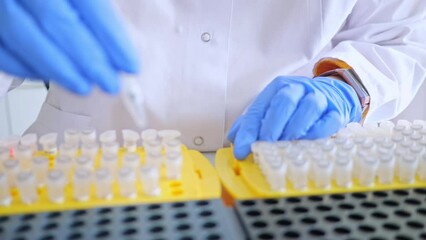 Wall Mural - Laboratory scientist working at lab with test tubes. Laboratory concept, woman technician chemist sorts medical samples. Medical diagnostics, research and science background.