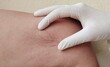 © Rung Kh - Portrait showing the hand holding the flabbiness skin and varicose veins on the leg, circulation of blood, problem wrinkle and inflammation skin of the patient woman, concept health care.