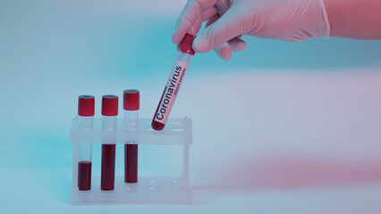 Wall Mural - partial view of scientist in latex glove taking test tube with blood sample and coronavirus lettering on blue.