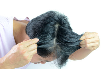 White hair problems in men, asian man with white hair, white hair or hair loss problem.