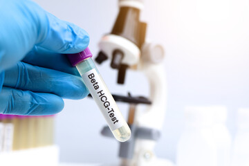 Sticker - Urine samples for testing HCG in the laboratory