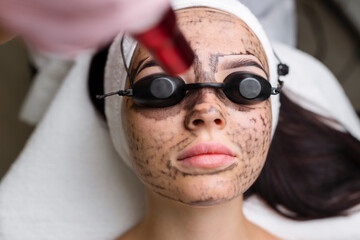 Wall Mural - Beautician doing hardware carbon peeling to a young beautiful client in a headdress in goggles lying on a sofa in a beauty salon. Facial cleansing concept. Cosmetology services