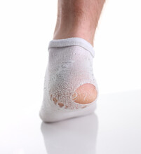 Torn White Sock On Man Leg Closeup