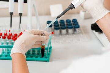 using microdoser for blood analysis and test in laboratory. medical equipment in lab. scientist with