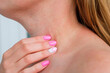 Allergic dermatitis on skin of woman's neck. Skin disease. Neurodermatitis disease, eczema or allergy rash. Healthcare and Medical. Desquamation of skin