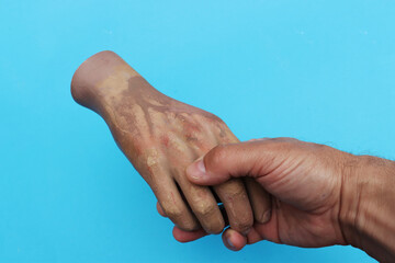 Wall Mural - A real human hand holding an artificial plastic hand.