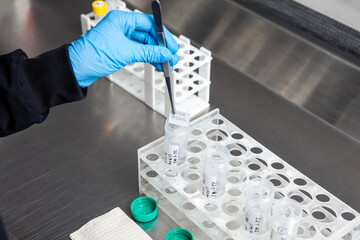 Scientist preparing slides for karyotipe and fluorescence in situ hybridization - FISH in the laboratory. Acute lymphocytic leukemia.  Translocation 4;11.