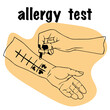 allergy test. The doctor holds pipette in his hand for examination. hand palm up, conducting skin allergy test. for medical website, advertising medicines. patient with an allergic reaction.