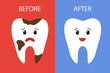 an unhealthy tooth and a healthy tooth. Vector illustration