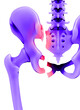 © Science RF - Fractured pelvis, illustration