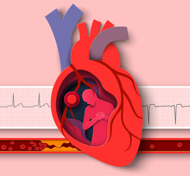 Fototapete - Heart attack paper cut vector cardiology disease