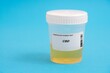 CBD. CBD toxicology screen urine tests for doping and drugs