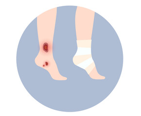 Sticker - Human leg injury